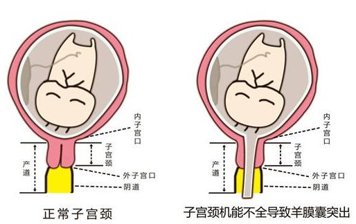 incompetence-incompetence和incompetency的区别