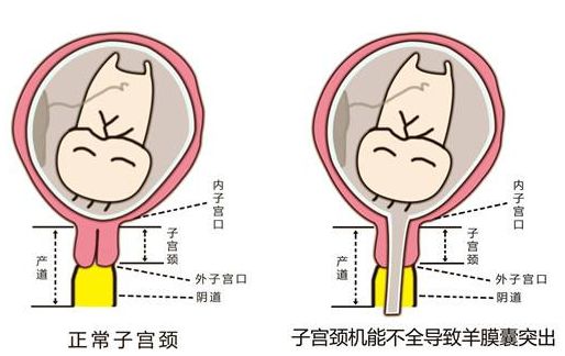 incompetence-incompetence和incompetency的区别