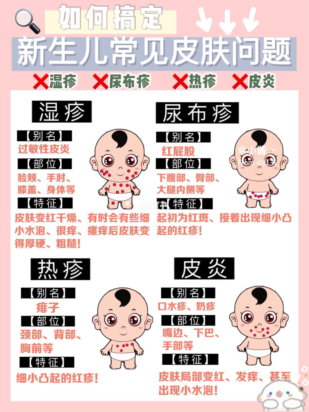 去除婴儿热疹小妙招-小孩热疹最佳治疗方法