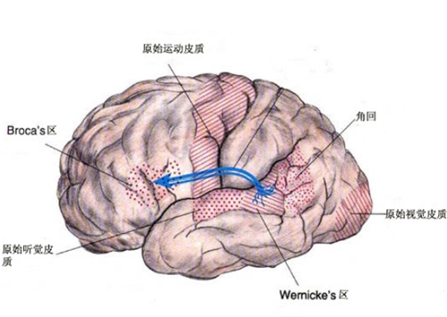 电报式语言是什么失语-电报式语言的特征是,基本上是由实词构成